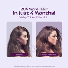 RootStim rosemary biotin formula nourishes the scalp for stronger roots.