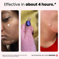 ROSELYNBOUTIQUE pimple patches in four sizes for a precise fit.