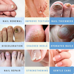 Scientific Solutions Global urea-50-nail-gel nails-after-treatment with brighter, smoother appearance.