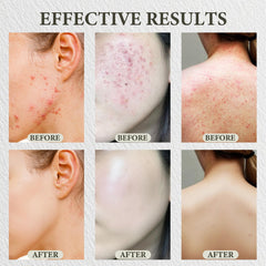 SDXJIOGE Back application demonstrates multi-area use for pores and oil balance.