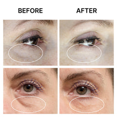 SEAMANTIKA Eyeliss complex illustration explaining fast under-eye tightening effects