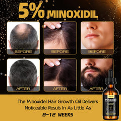 Sefralls Biotina Suero Cabello Nutrición: fortalece raíces y favorece mechones sanos.