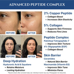 Seraphime Copper Peptides Serum with EGF for a refreshed complexion
