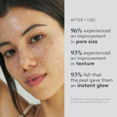 SHANI DARDEN Triple Acid Peel application showing exfoliation for smoother skin