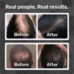 Shapiro MD Hair Growth Experts logo indicating dermatologist-developed formulation