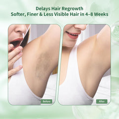 ShineMore oil application after hair removal for post-treatment nourishment.