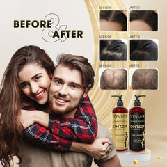 Shiny Leaf DHT Pro natural plant extracts droplets highlighting nourishing care.
