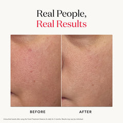 SK-II essence in hand during application promotes smooth, even texture.