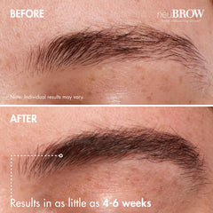 Skin Research Laboratories neuBROW packaging closeup shows vegan, cruelty-free formula