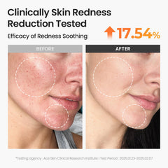 Después del sol, sensación fresca de SKINFOOD Carrot Toner Pad alivia