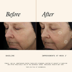 Dropper dispensing SkinMedica TNS Advanced+ Serum during morning routine.