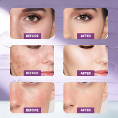 SKYNFLOW mask application close-up showing smooth texture on skin