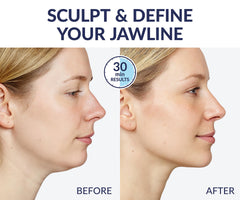 Stylia neck-tightening mask with strap supports neck contouring during sleep.