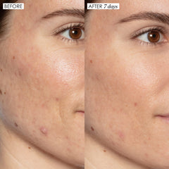 Sunday Riley Good Genes serum texture on skin shows creamy, exfoliating consistency.