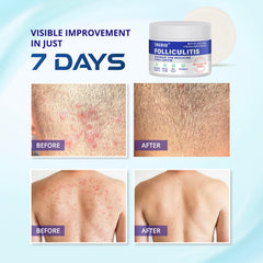 Hands applying TAGRID Cream demonstrates quick absorption and soothing feel.