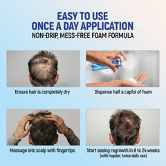 TARO Minoxidil foam dry-down on scalp without greasiness