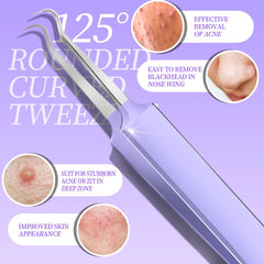 Teenitor ergonomic pimple extractor with anti-slip grip supports precise control during extractions.