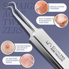 Teenitor pimple extractor with ergonomic loop designed for precise control.