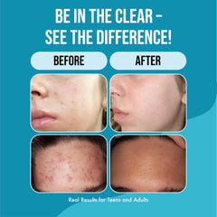 Teenology Teen Shampoo being applied creates rich lather for daily washing.