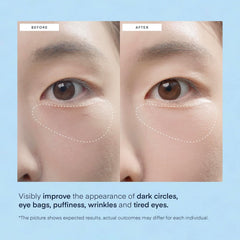 TEREZ & HONOR caffeine-infused patches reduce puffiness around the eyes.