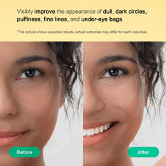 TEREZ & HONOR patches showcase 9-layer hyaluronic surge for deep hydration and plumping.
