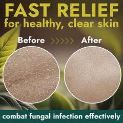 Terramed Just Think Comfort aloe vera enriched ingredients for hydration