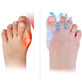 Tevezo toe spacers kids pair for comfortable toe alignment during daily wear.
