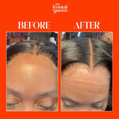 The Frontal Queen lace-bond-spray offers secure hold for confident wear.