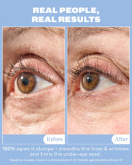 Then I Met You snail mucin eye cream ceramic-tip application cools and depuffs.