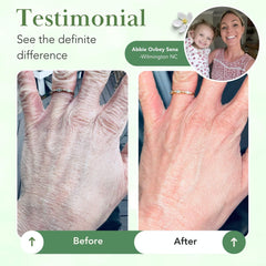 Theraplex balm application on skin demonstrates easy use on dry areas.