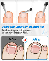 Tisojpod nail clippers with dual-V blades for tough nails.