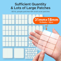 TKTK pimple patches 60x20mm provide medium coverage for mid-sized breakouts.