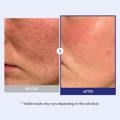 TOSOWOONG Panthenol 20 Barrier Cream ingredient view highlights ceramides and hyaluronic acid for moisture.