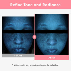 Applying TOSOWOONG PDRN Hyaluron Face Cream for refreshed, comfortable skin.