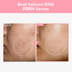 TOSOWOONG serum dispense pump shown for easy daily application and control