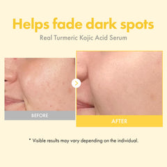 Ingredients highlight kojic acid and turmeric in the Real Turmeric Serum