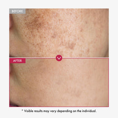 TOSOWOONG serum textura ligera de absorción rápida.