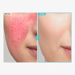 Barrier texture close-up showing SOS Repair cream's protective feel.