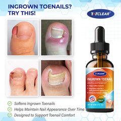 TOTCLEAR softening drops bottle for easy daily use and comfortable nails.