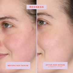 Tower 28 SOS Rescue application during routine uses 2-3 pumps for calm skin