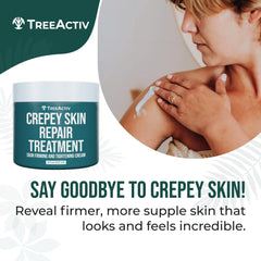 TreeActiv Crepey Skin Repair Cream applying on arm to soften crepey skin