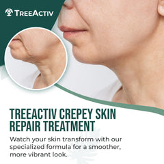 TreeActiv Crepey Skin Repair Cream texture detail highlighting smoothness in creamy formula