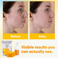 Treeroot cepillo limpieza facial, mejora exfoliación suave.