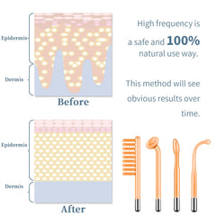 TUMAKOU mushroom tube used for broad facial areas.