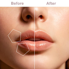 Tuokiy rose gold facial hair remover for daily, gentle use.