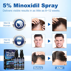 Tuymec Minoxidil 5% para mujeres con cabello fino