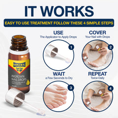 URIEL home treatment setup for toenails illustrates easy at-home care routine.