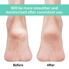 Vaincre gel heel socks with vitamin E and mineral oils for moisturized feet