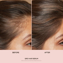 VEGAMOUR GRO Hair Serum dropper application demonstrates daily scalp care for thinning hair