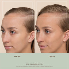 VEGAMOUR GRO+ wide-head roller ready for quick scalp coverage